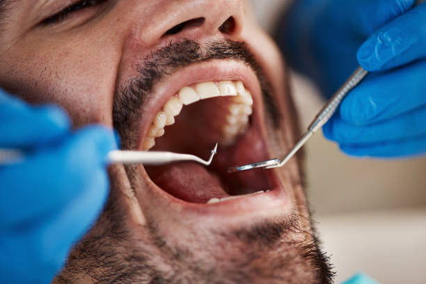 Best Pediatric Emergency Dentist in Fairmont City, IL