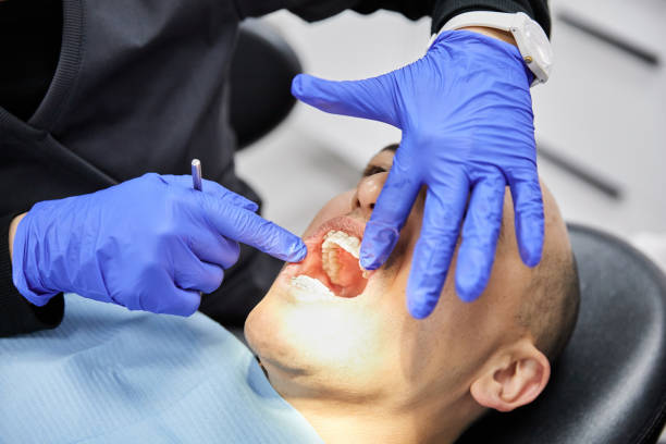 Best Emergency Treatment for Dental Infections or Abscesses in Fairmont City, IL